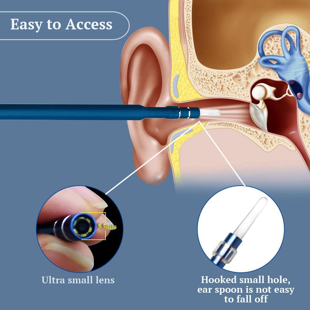 Visual Ear Cleaning Endoscope